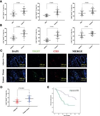 TIGIT Induces (CD3+) T Cell Dysfunction in Colorectal Cancer by Inhibiting Glucose Metabolism